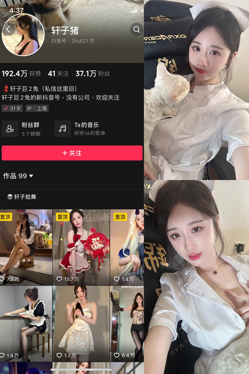 抖音 轩子巨二兔 微密圈 NO.023期 【8P1V】