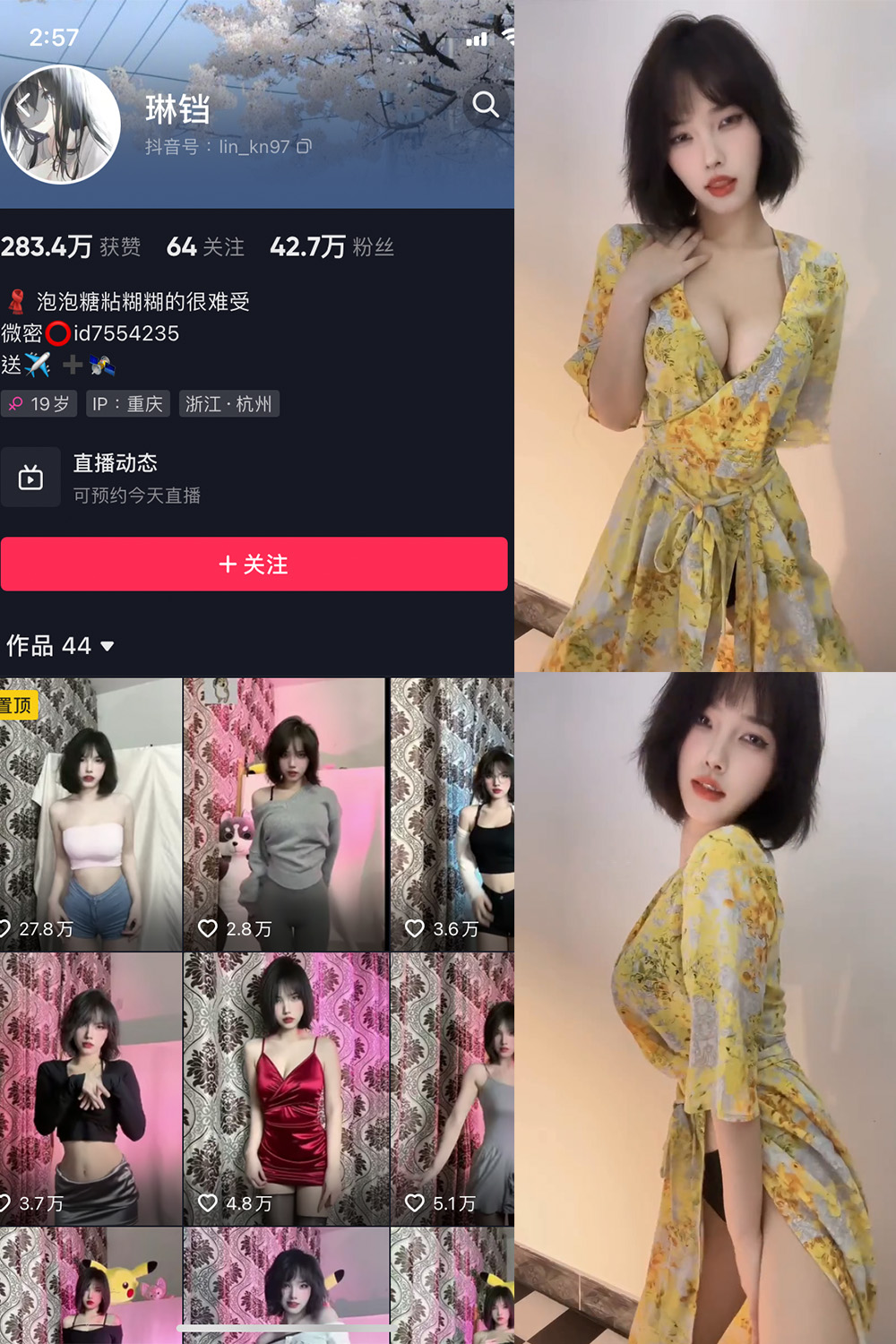 抖音 琳铛 微密圈 NO.016期 【10P3V】