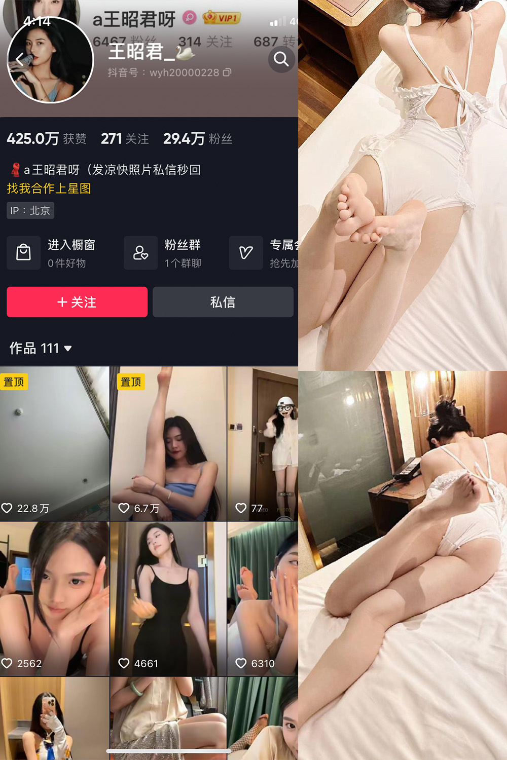 抖音 王昭君 微密圈 NO.007期 【29P6V】