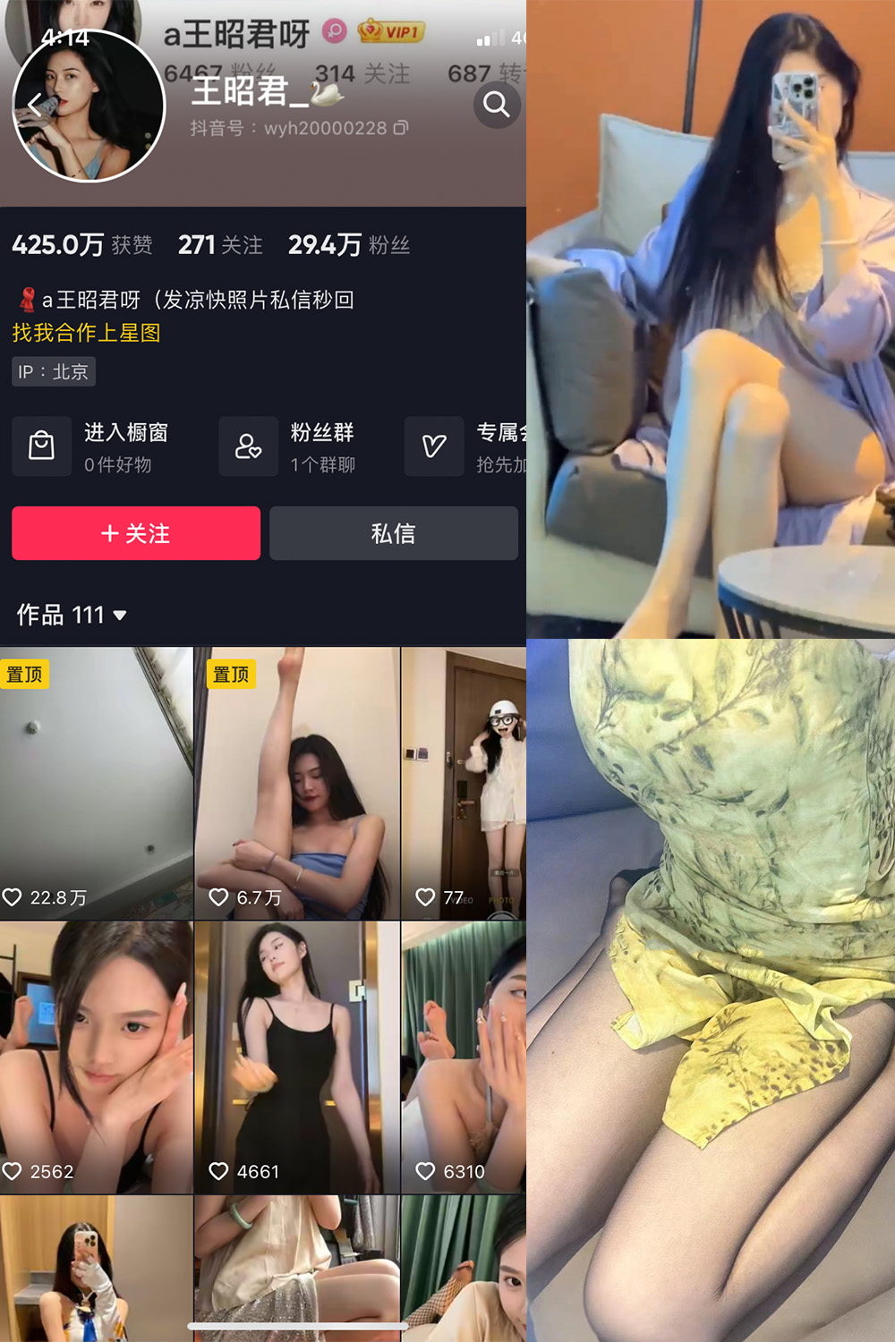 抖音 王昭君 微密圈 NO.014期 【16P1V】