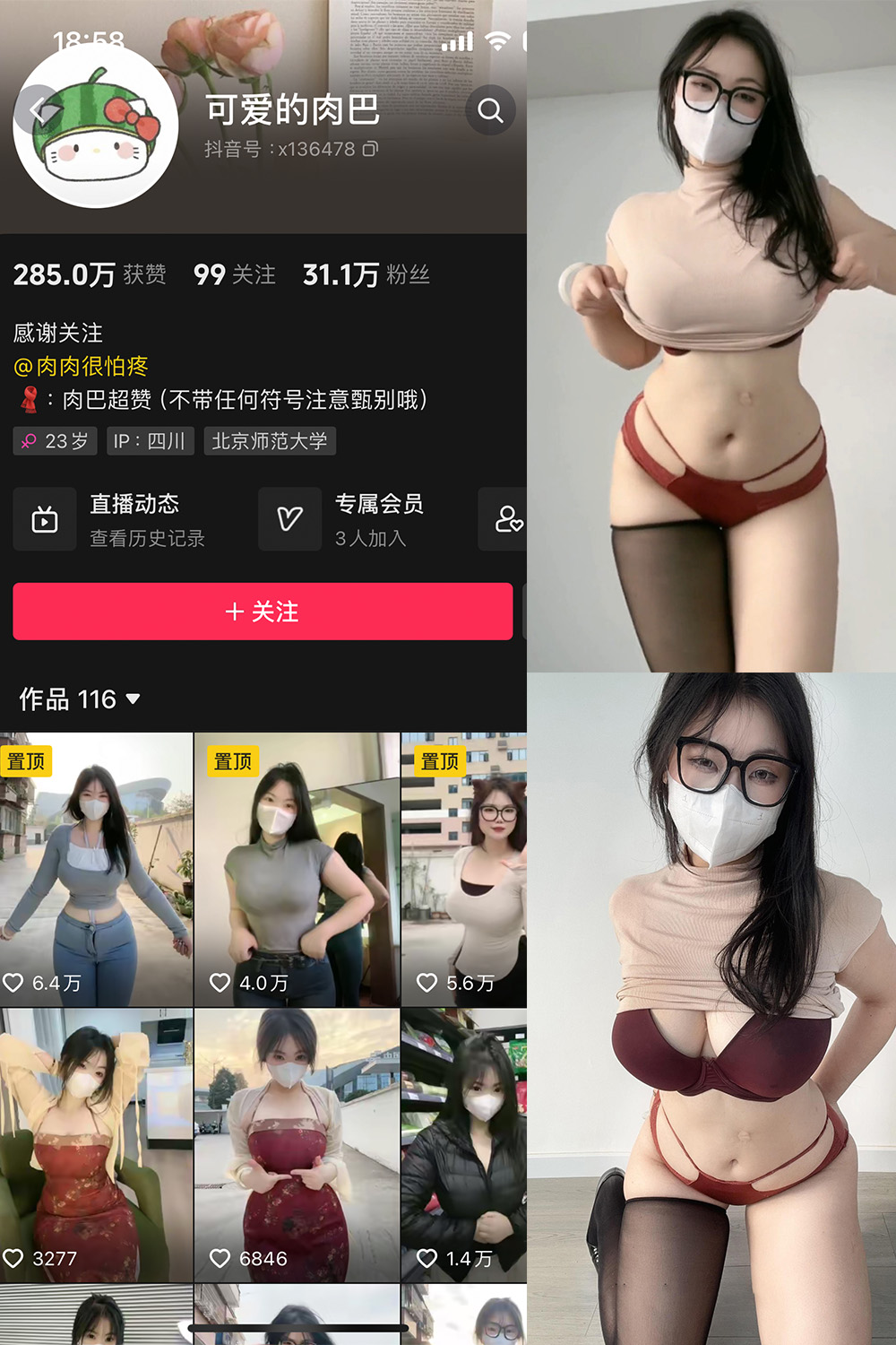 抖音 可爱的肉巴 微密圈 NO.009期 【18P11V】