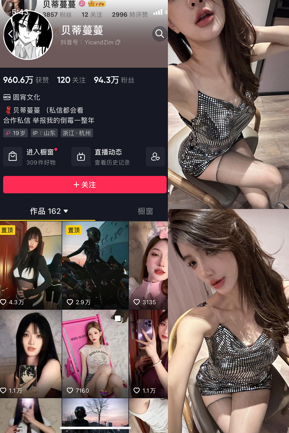 抖音贝蒂蔓蔓 微密圈 NO.007期 【30P1V】