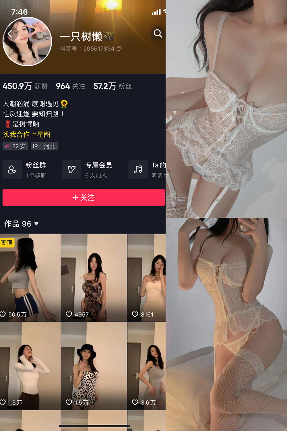 抖音 一只树懒 微密圈 NO.002期 【21P5V】