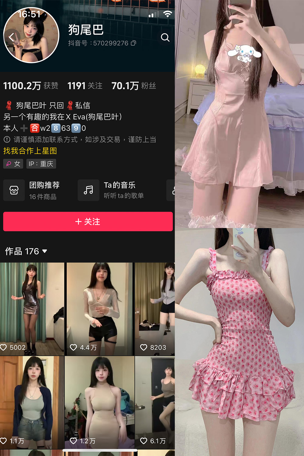 抖音 狗尾巴 微密圈 NO.004期 【25P5V】