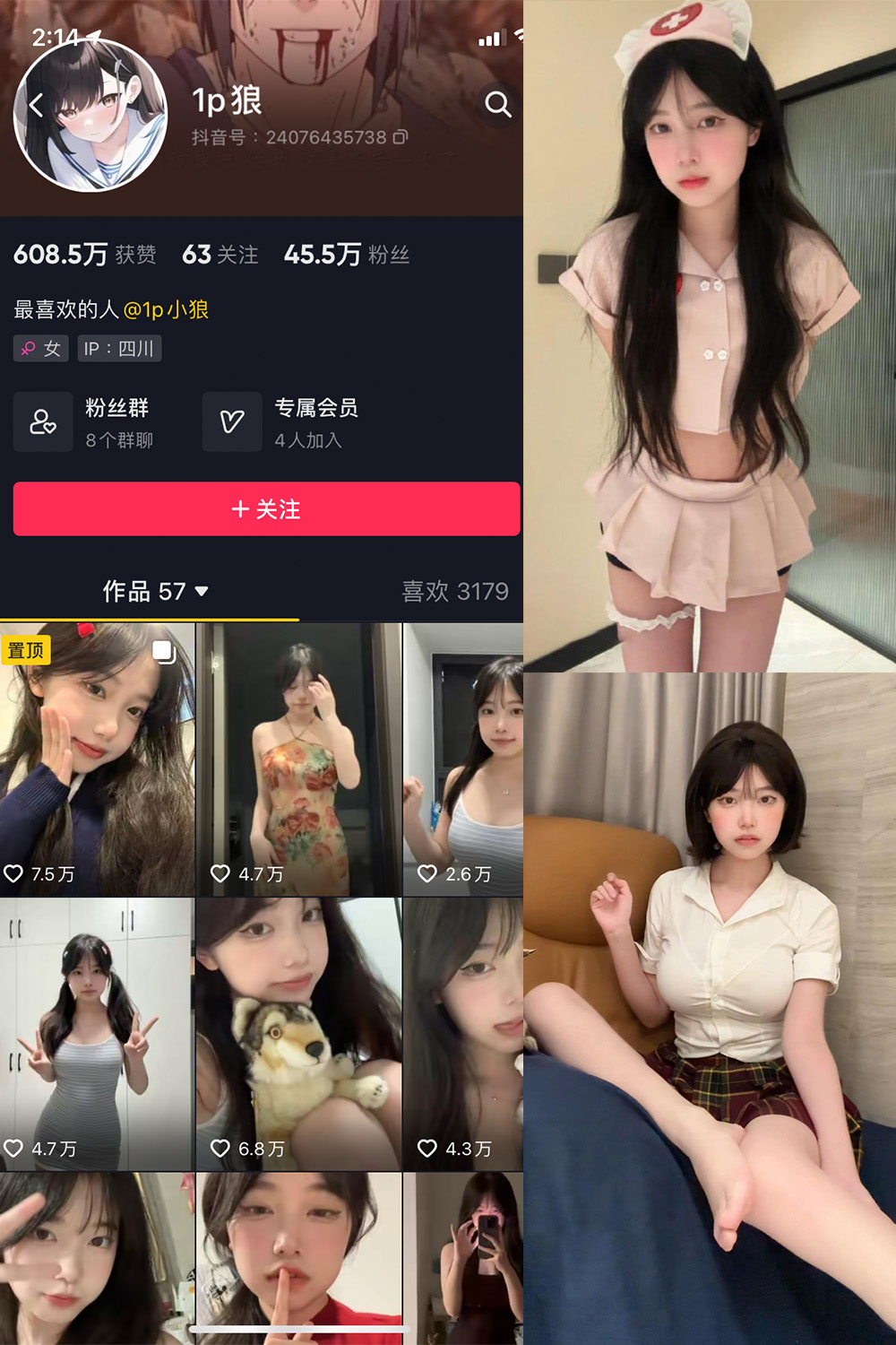 抖音 1p狼 微密圈 NO.006期 【12P3V】